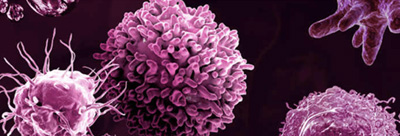 Immuno-oncology <i>in vitro</i> assays